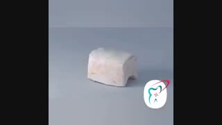 جراحی پیوند لثه
