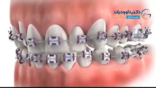 ارتودنسی تهران | دکتر داوودیان