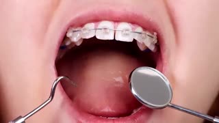 آیا ارتودنسی یک فک امکان پذیر است؟ | دکتر سعید قریشی