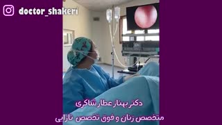 هیستروسکوپی پولیپ