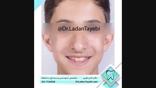 درمان ارتدنسی جهت اصلاح بی نظمی دندانی | دکتر لادن طیبی