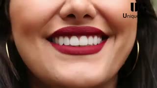 چرا دندان ها را لمینت کنیم؟ | دکتر لیلا عطایی