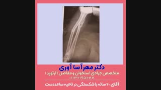 عمل جراحی شکستگی ساعد دست