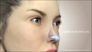 جراحی زیبایی بینی | رینوپلاستی