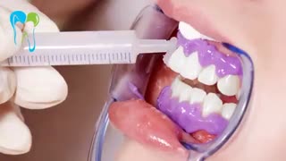 اقدامات بعد از درمان بلیچینگ | دکتر شبنم شریفی میلانی