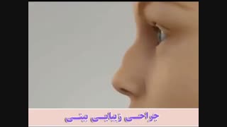 انیمیشن جراحی زیبایی بینی
