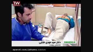 پایان رنج بیماران قطع نخاعی و درمان زخم بستر
