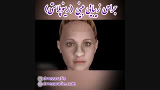 جراحی زیبایی بینی | دکتر رفیع