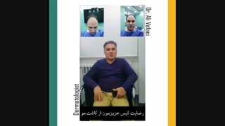 رضایت مراجعه کننده از کاشت مو به روش ترکیبی