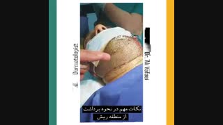 برداشت از منطقه ریش