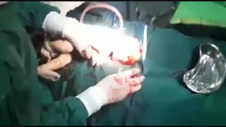 فیلم عمل زایمان بدون سانسور