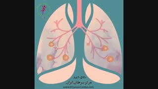 علائم سرطان را بشناسیم!