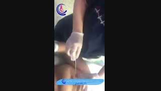 استفاده از ماده رنگی بلومتیلن به جای رادیواکتیو