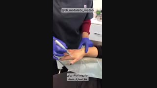 میکرونیدلینگ برای جوانسازی دست مزوتراپی