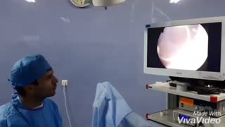 فیلم عمل جراحی توده مثانه