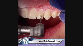 پایان درمان ارتودنسی.دکترعلیرضاخدیوی .متخصص ارتودنسی
