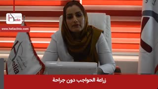 زراعة الحواجب دون الجراحة | عیادة هلیا | 00989120234708