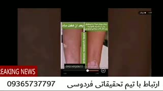 پیسی چیست و آیا در طب پزشکی درمان قطعی دارد؟؟