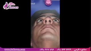 عمل زیبایی بینی