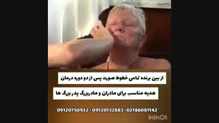 کرم ضد لک 09120750932 زاویه سازی صورت