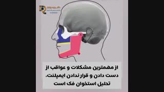 عوارض نداشتن دندان