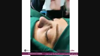 فیلم جراحی بینی نیمه فانتزی