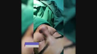 فیلم جراحی بینی توسط دکتر حاتم صالح پور
