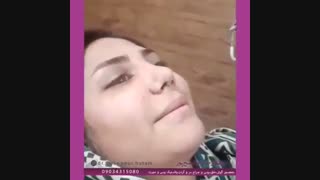 فیلم جراحی بینی گوشتی