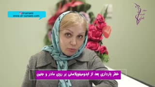 خطرات بارداری بعد از جراحی ابدومینوپلاستی روکش دندان
