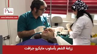 زراعة الشعر بطریقة مایکرو جرافت | عیادة هلیا | 00989120234708