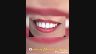 ۸ واحد کامپوزیت ونیر فک بالا | دکتر حامد صالحی