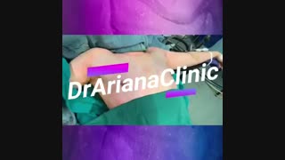 فیلم جراحی سینه در مردان با حداقل برش!