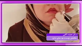 فیلم تزریق ژل خنده ترمیم دندان