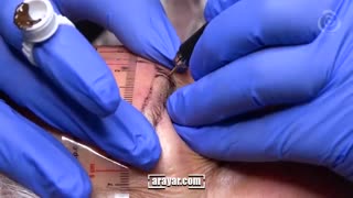 فیلم آموزش کامل میکروبلیدینگ ابرو