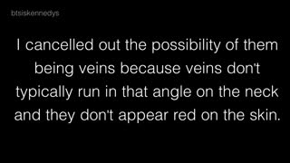 بررسی کبودی روی گردن جونگ کوک و خراش روی گردن تهیونگ تو قسمت17بنگتن ران