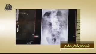 جراحی ستون فقرات