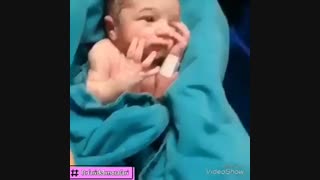 زایمان سزارین