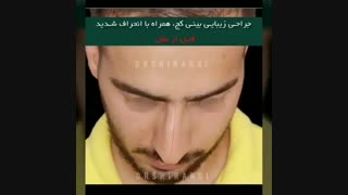 جراحی بینی کج با انحراف شدید بینی