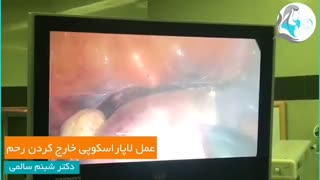 عمل لاپاراسکوپی خارج کردن رحم
