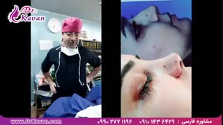 عمل بینی توسط دکتر کاوان
