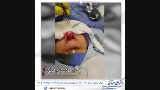فیلم عمل ترمیمی بینی