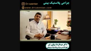 جراحی پلاستیک بینی
