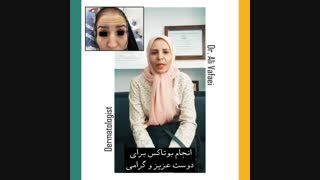 بوتاکس خانوم ها