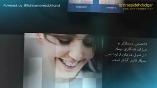 طول درمان ارتودنسی چقدر است؟ | دکتر سپیده دادگر