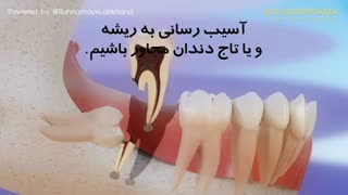 آیا دندانهای عقل میتوانند باعث ایجاد نامرتبی دندانی شوند؟ | دکتر دادگر