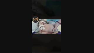 تومور بزرگ صورت