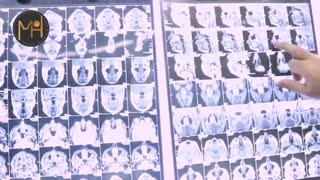 فیلم تومور لب