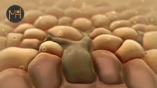 جراحی تومور زبان