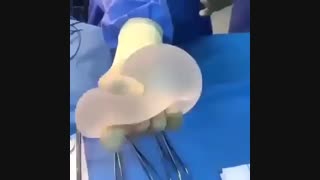 مقاومت پروتز