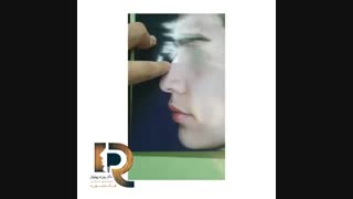 جراحی بینی استخوانی